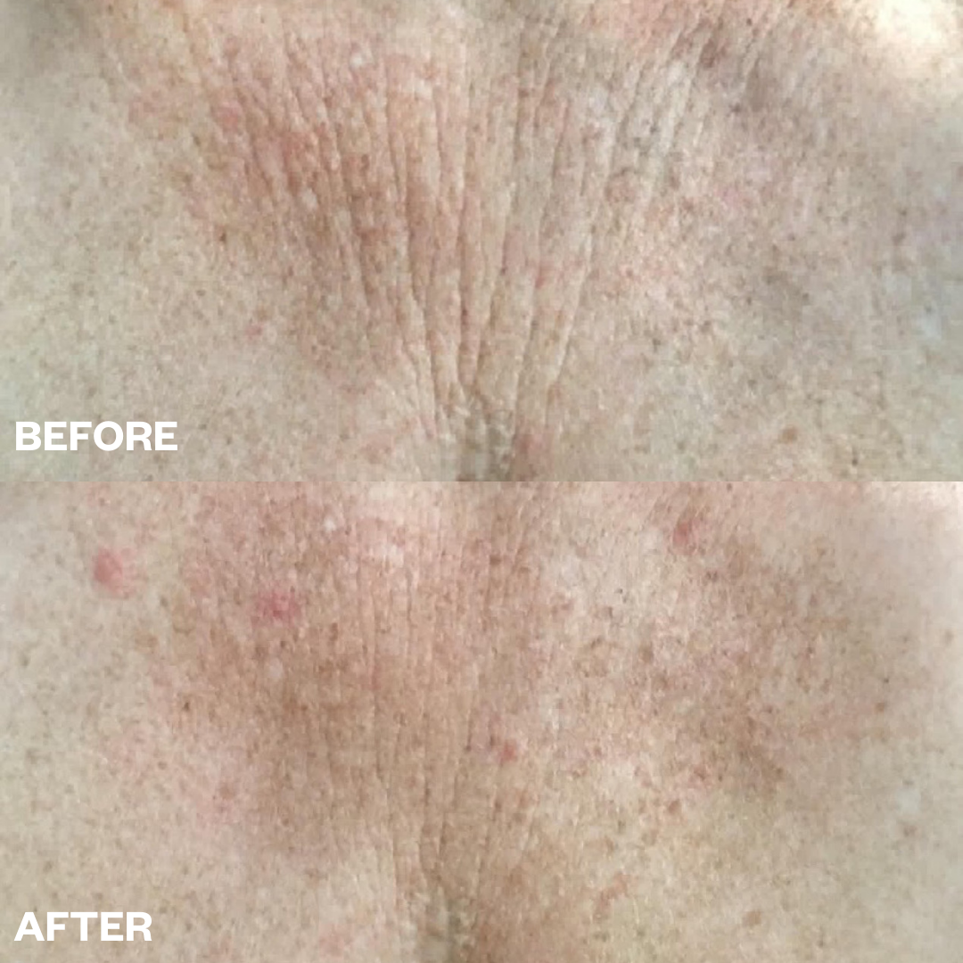 Wrinkle Schminkles | Chest Wrinkle Patch